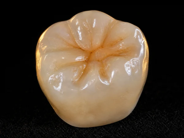 Couronne Zircone Monolithique